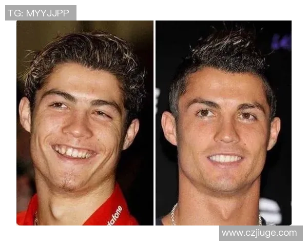 足球明星整容真相揭秘他们的外貌变化背后的故事